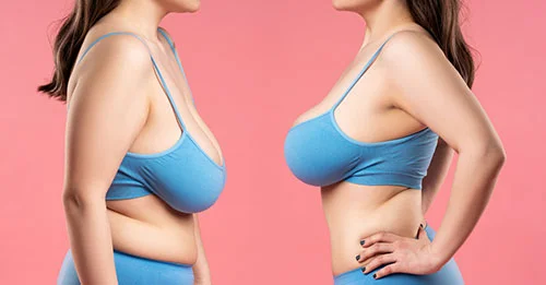 Breast Augmentation in Antalya Antalya Estate